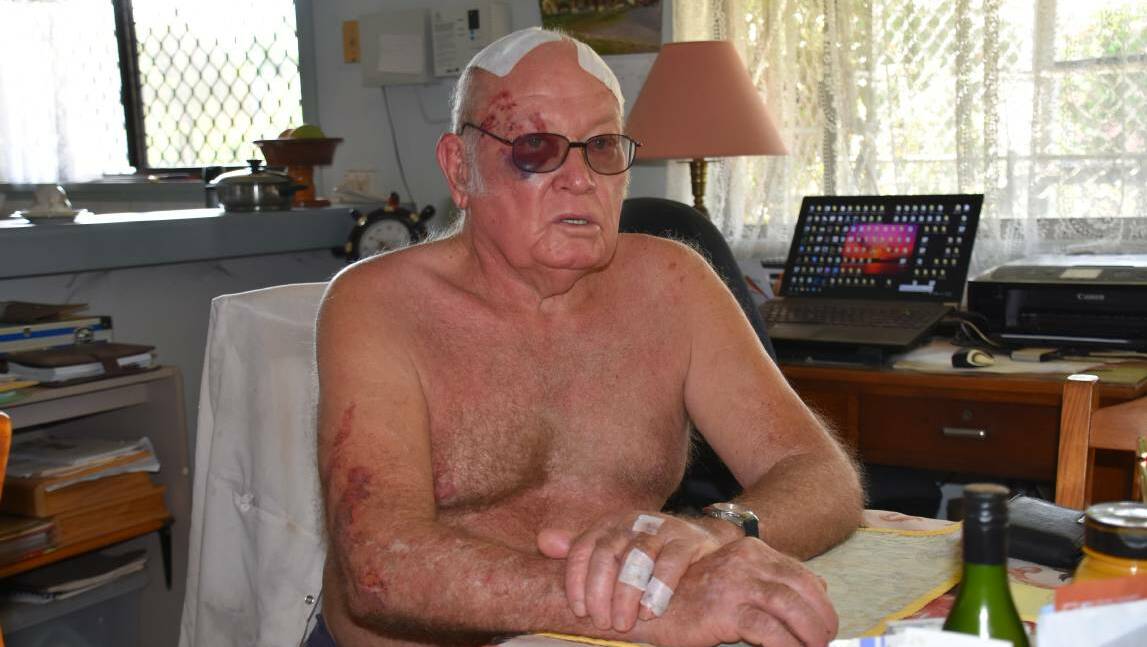 Katherine East resident Bevan Gistham was attacked without warning in his home earlier in the week and badly injured. Picture: Roxanne Fitzgerald.